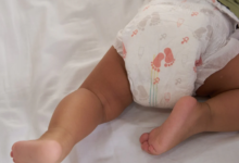 Bebek Bezi Egzaması Nasıl Önlenir ve Tedavi Edilir
